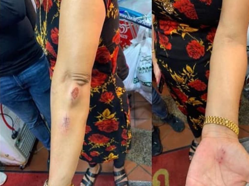 Madam Hindocha Nita Vishnubhai was brisk-walking along Choa Chu Kang Drive on May 7, 2021, when a man approached her and asked her to pull her mask up from her chin. Madam Hindocha Nita Vishnubhai was brisk-walking along Choa Chu Kang Drive on May 7, 2021, when a man approached her and asked her to pull her mask up from her chin.