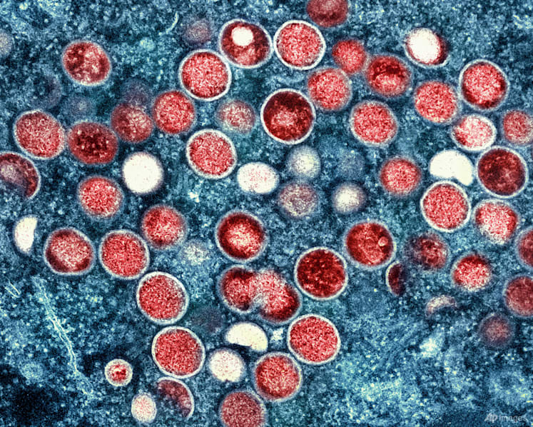 Mpox outbreak in Africa: Immediate risk to Singapore is low, says Health Ministry