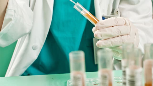 本地研究：尿液检测或可提升早期泌尿系统癌症检测能力