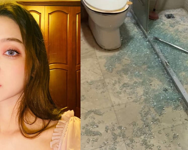 Chinese Actress Zhang Zhaoyi’s Bathroom Glass Door Shatters, Injures Both Husband And 1-Year-Old Child