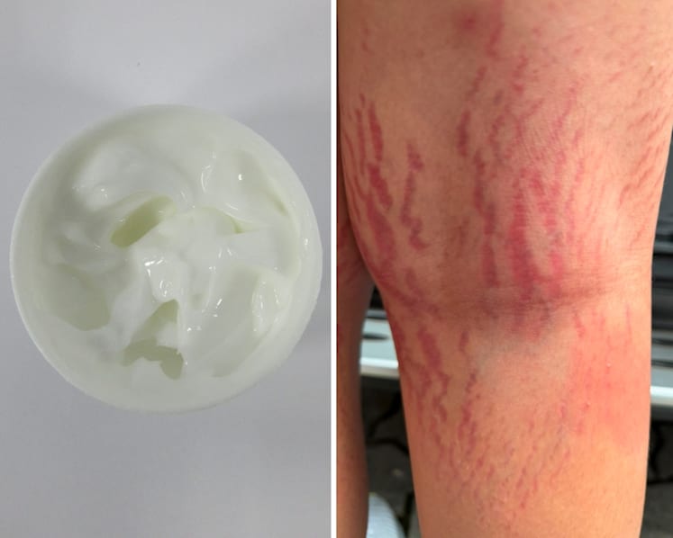 HSA warns against 3 products after consumers, including a 12-year-old, suffer serious health effects 