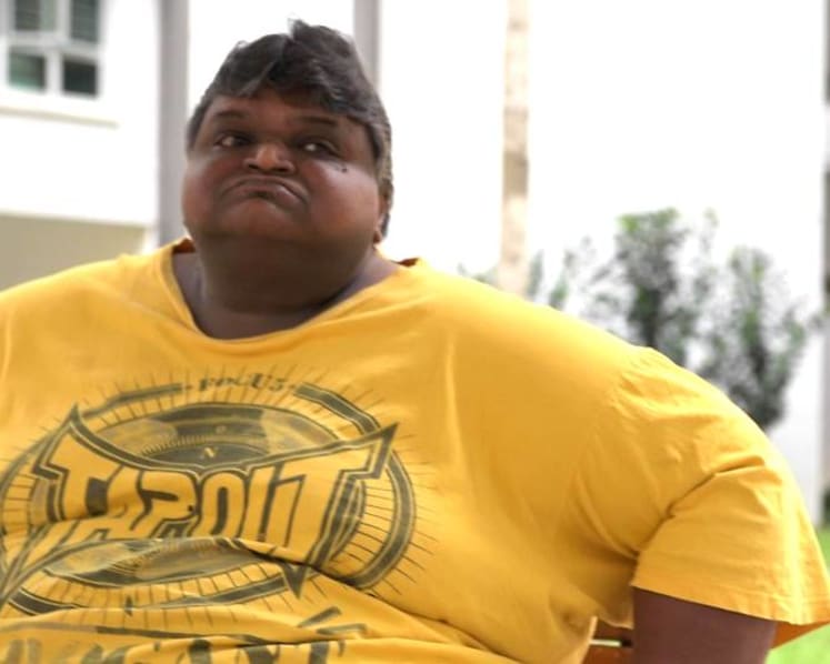 Morbidly obese at 212kg, he had a hard time even walking. A surgery changed that
