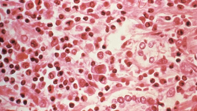 jelasBERITA: Apa itu hantavirus?