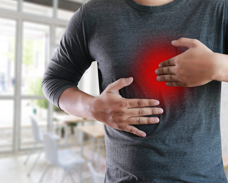 Managing acid reflux attacks with TCM