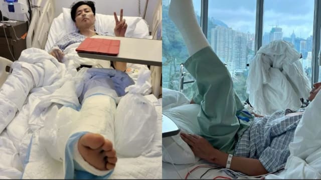 张晋拍戏出意外！脚伤严重打石膏，还装上鼻导管
