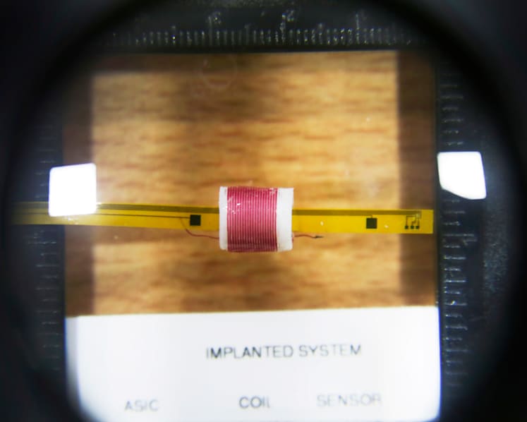 Making life easier for people with kidney disease