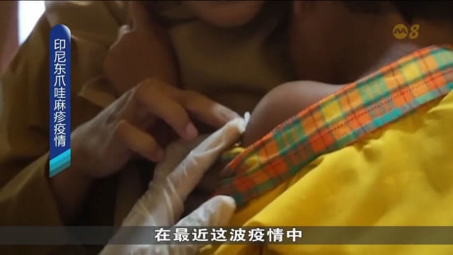麻疹爆发致17童亡 印尼漯水急发疫苗控制疫情