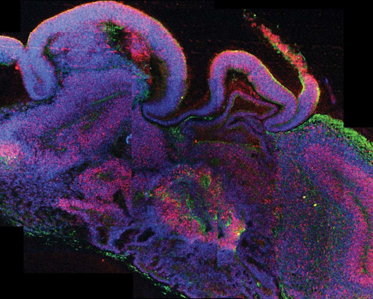 Explainer: Why scientists are growing 'mini human brains', and why this might be unethical