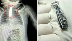 Related article image