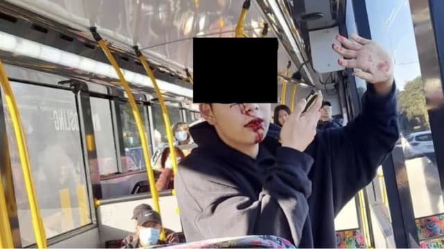 新西兰华裔少年疑遭种族歧视 公共巴士上遭妇女持铁杆袭击