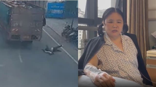 为救陌生男童自己被车撞 四川女子：永久断臂但值得