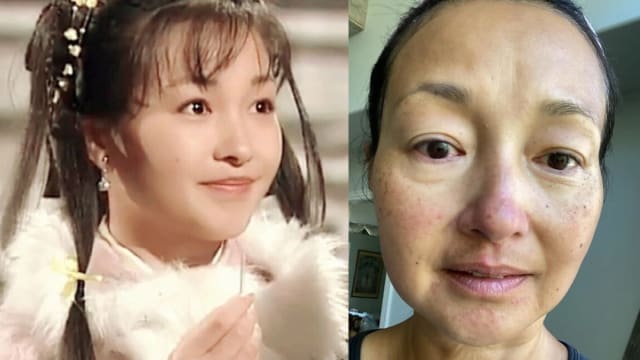“最美郭襄”李绮虹　满脸雀斑惊呆网友