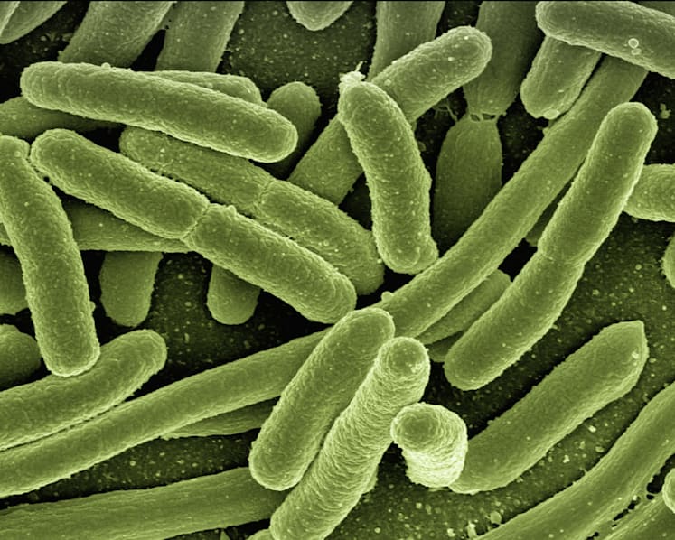 Refocusing on fighting antimicrobial resistance when the pandemic eases