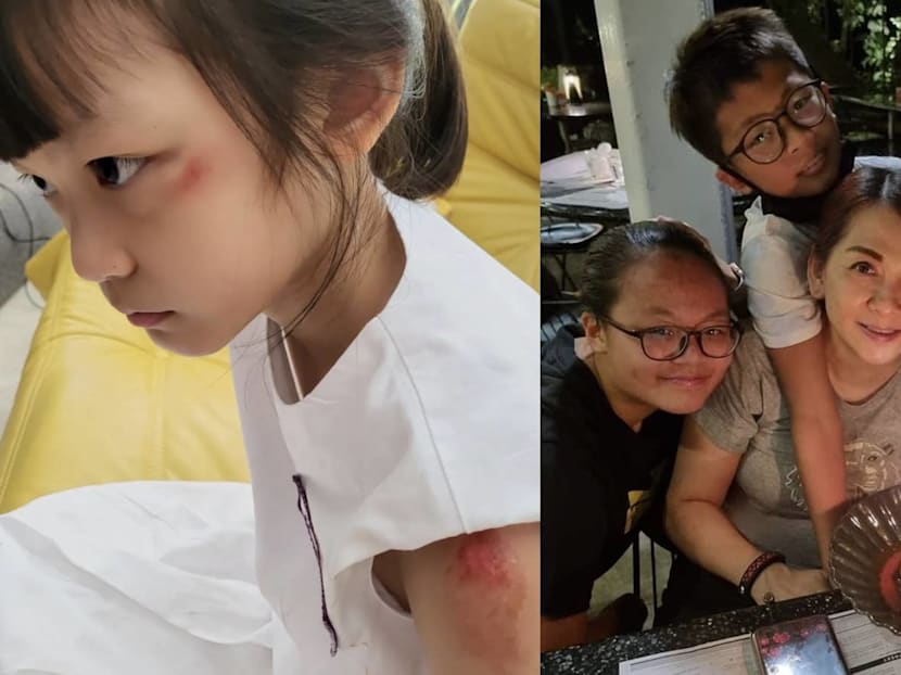 Mark Lee&rsquo;s Wife Urges Parents To Remind Their Kids To Be Careful After Daughter Calynn Gets Injured Playing Catching