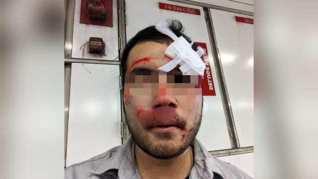在隧道内疑遭汽车擦撞 骑士锁骨骨折额头缝针
