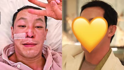 Hong Kong Fashion Heir Harris Chan Spent S$330K On Facial Reconstruction Surgery After Crash Left Him Disfigured 