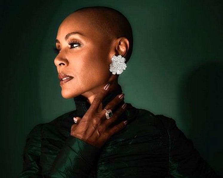 What is alopecia areata, the medical condition behind Jada Pinkett Smith's hair loss?