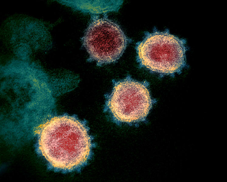 25 Covid-19 cases with B117 variant found in Singapore: MOH