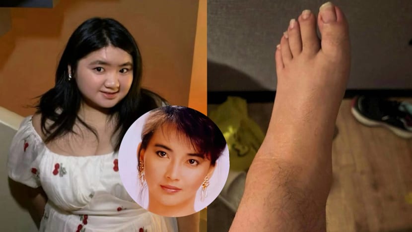Daughter Of '80s Taiwanese Actress Hu Huichung Praised For Showing Her Unshaven Legs In Pics