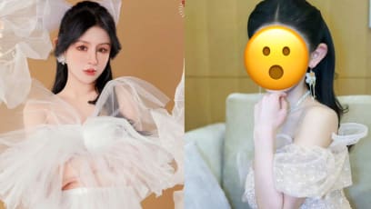 Chinese Influencer, 20, Has Spent More Than S$746.5K On Hundreds Of Plastic Surgery Procedures Since She Was 13