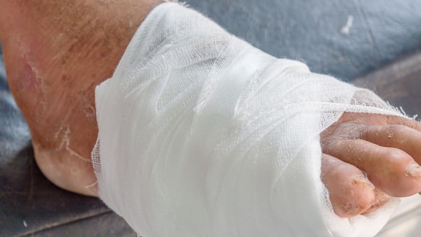 Doctor suspended after diabetic patient with infected foot had leg amputated