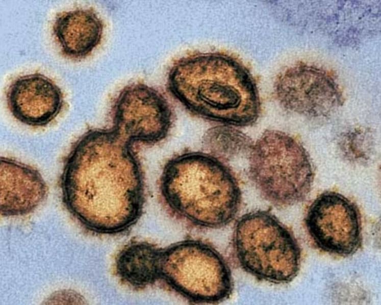 Doctors in Singapore advised to look out for blood, heart problems in COVID-19 patients