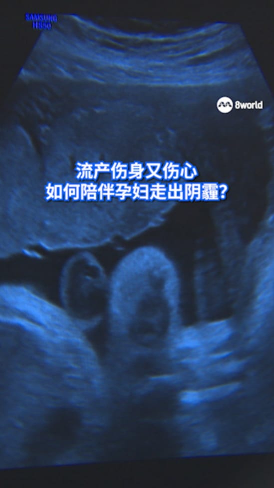 MISCARRIAGE REEL