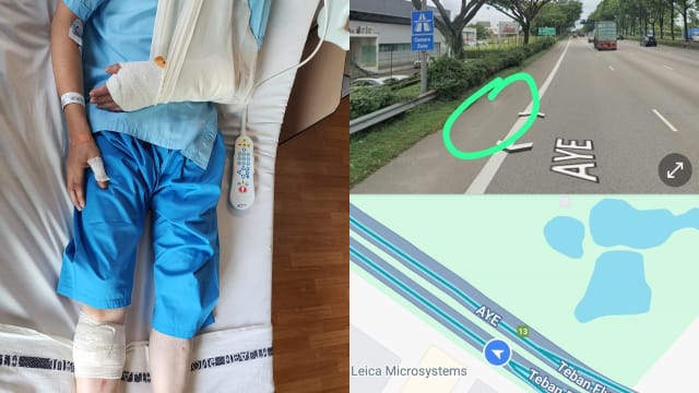 疑被撞后逃致骨折 失聪摩托骑士网上寻目击者