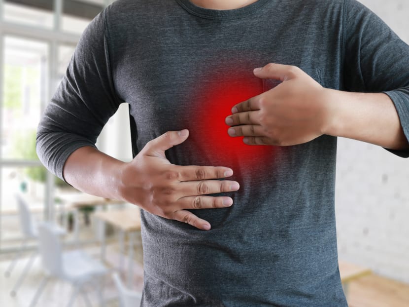 Heartburn can be a symptom of gastroesophageal reflux disease. Photo: Shutterstock Heartburn can be a symptom of gastroesophageal reflux disease. Photo: Shutterstock