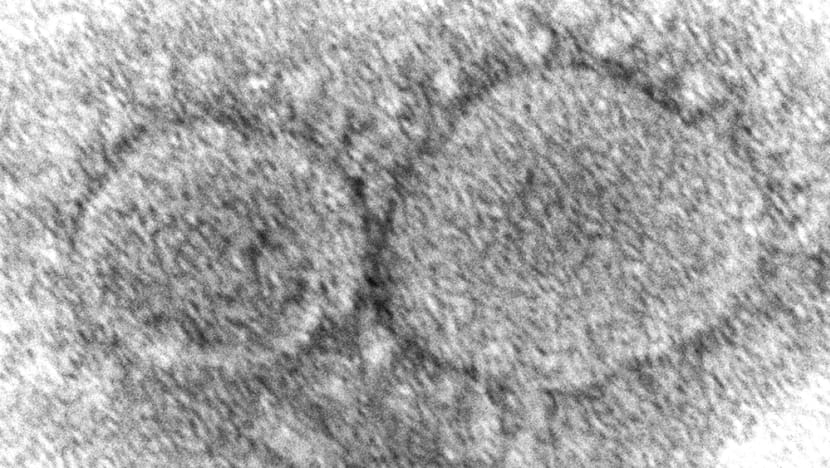 Coronavirus origins still a mystery 3 years into COVID-19 pandemic Coronavirus origins still a mystery 3 years into COVID-19 pandemic