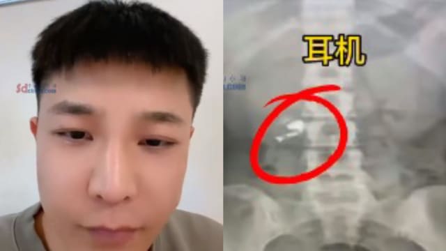 中国男子睡醒不见一边耳机 播歌惊觉肚里传出音乐