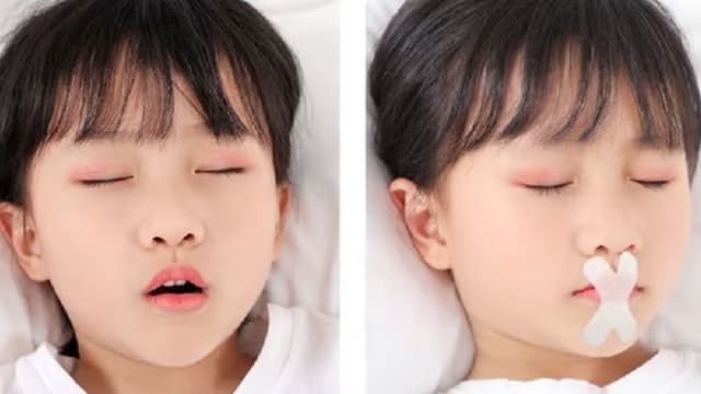 网称熟睡儿嘴上贴胶布可矫正歪牙 卫生科学局：正展开调查