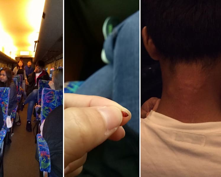 Bedbugs cause eight-hour nightmare for passengers on KL-Singapore coach