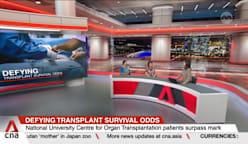 35 transplant patients from Singapore centre defied the odds, have lived beyond 25 years