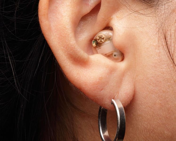 Think hearing aids are only for the elderly? Here’s why you may need them as early as in your 30s