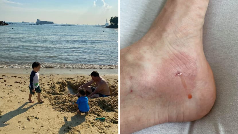 Sentosa urges visitors to be cautious following two incidents of marine stings