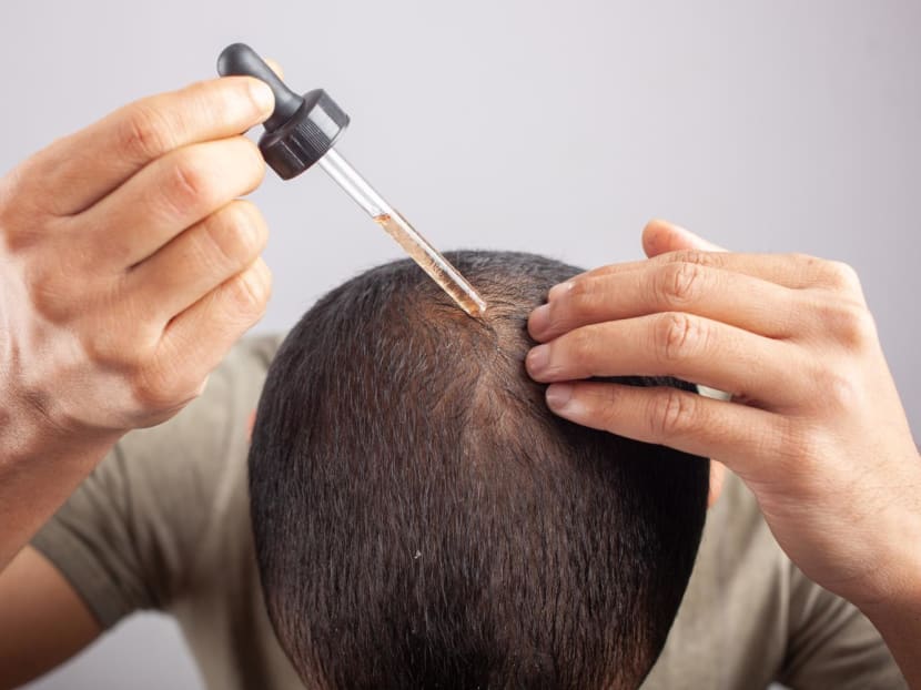 Minoxidil for hair loss: What you need to know about this widely used drug to restore hair growth Minoxidil for hair loss: What you need to know about this widely used drug to restore hair growth
