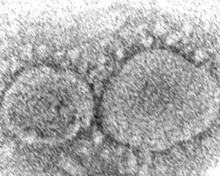 Coronavirus origins still a mystery 3 years into COVID-19 pandemic