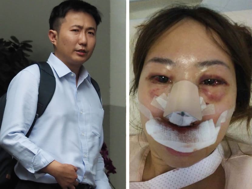 Clarence Teo Shun Jie is accused of brutally assaulting his then-girlfriend Rachel Lim in 2017 after she refused him sex. Clarence Teo Shun Jie is accused of brutally assaulting his then-girlfriend Rachel Lim in 2017 after she refused him sex.