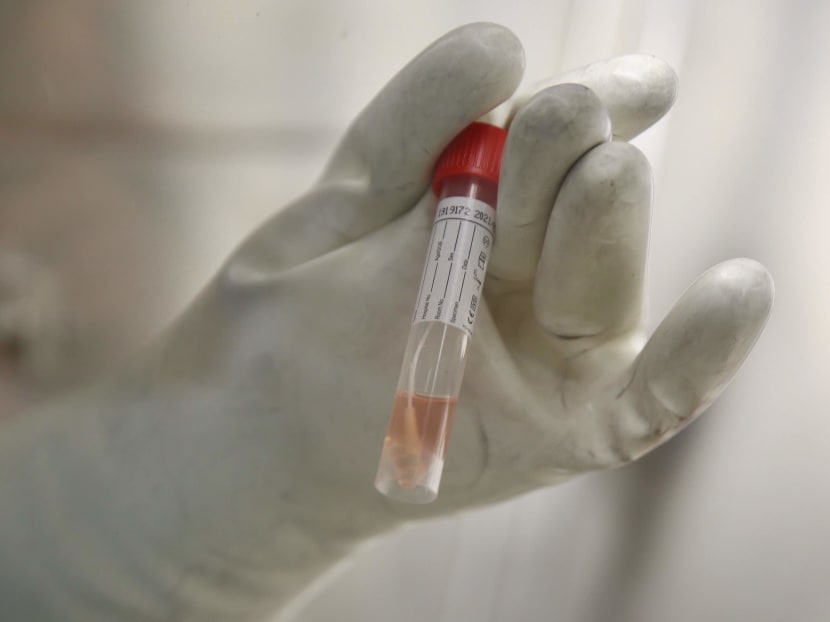 A sample of the Covid-19 test kit which is used to detect the coronavirus.