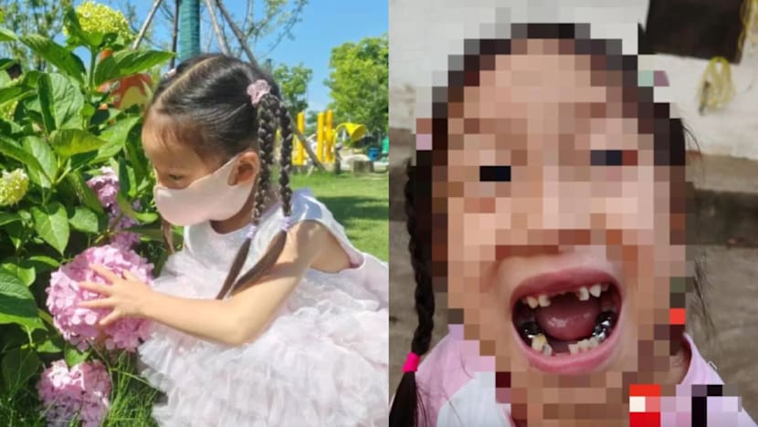 5-Yr-Old Girl Loses 4 Teeth After Robot Kicks Her In The Face During Science Museum Visit, May Be Left With Permanent Scar