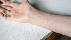 Related article image