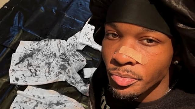 后车厢藏肢解遗体，遭疑腐尸案凶手的20岁男星发声！