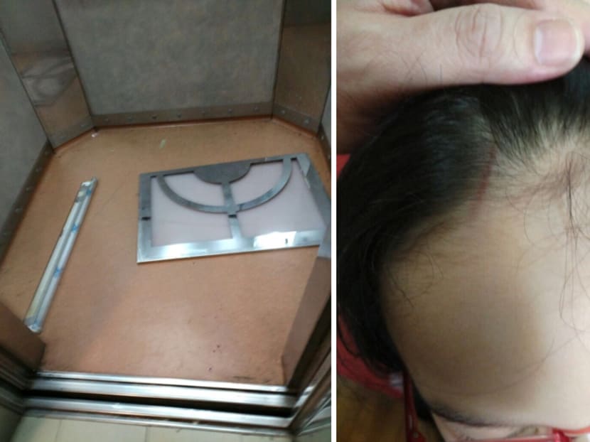 A light cover fell and hit 10-year-old Chung Yan Ting on her head and foot on Wednesday (June 7). She needed five stitches on her foot. Photos: Chung Koh Choon