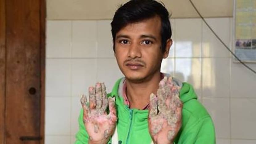 Related article image