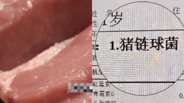 吃猪肉刺身30年　中国男子确诊脑膜炎