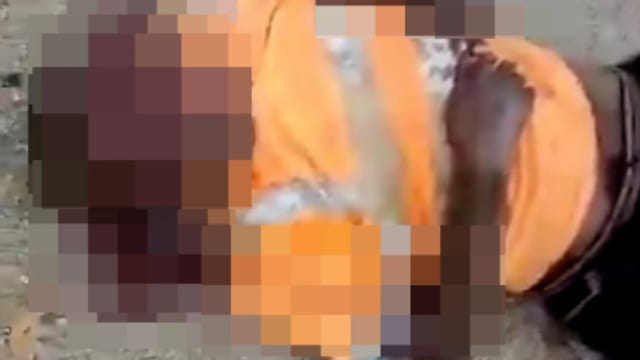 马国两男子起肢体冲突 一人遭对方挖出左眼球