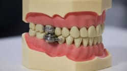 Related article image