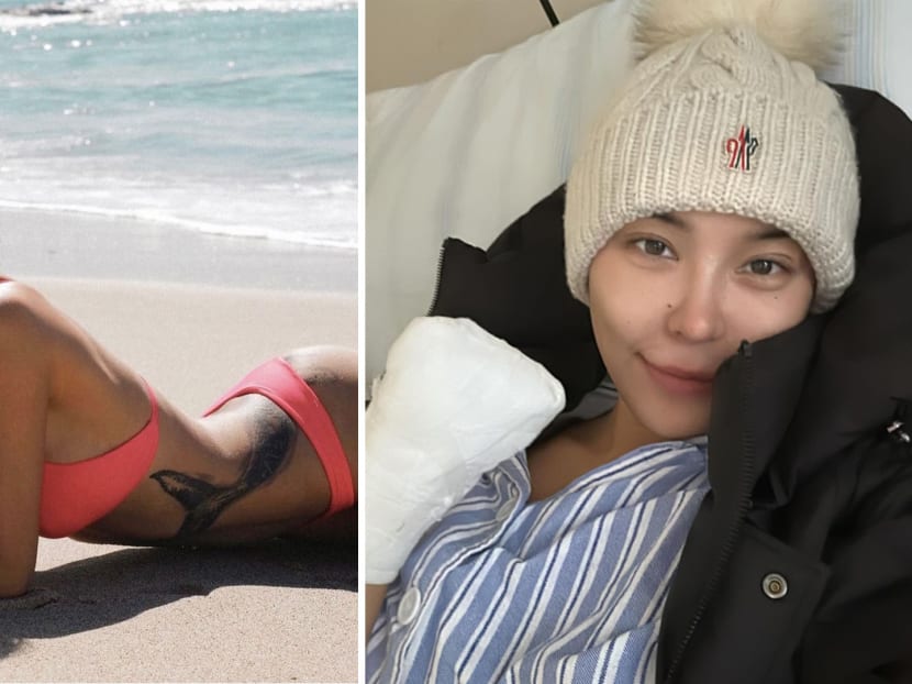 Chinese model Jessica Du has left hand amputated after accident, thanks hand for '35 years of companionship'