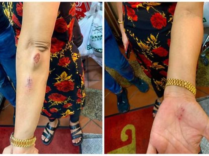 Madam Hindocha Nita Vishnubhai sustained injuries on her arms and hands after a man allegedly attacked her on May 7, 2021. Madam Hindocha Nita Vishnubhai sustained injuries on her arms and hands after a man allegedly attacked her on May 7, 2021.